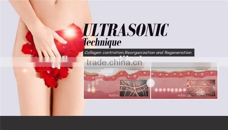 New Sex Vaginal Tightening Technology release woman private parts care / HIFU vaginal tightening beauty machine