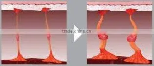 SUPER Cavitation Vacuum RF Slimming Machine