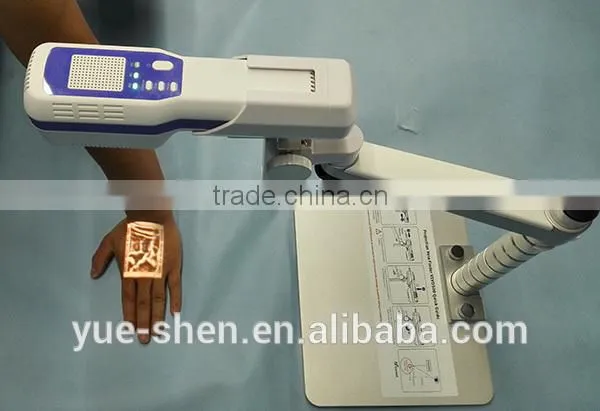 medical led projection vein viewer