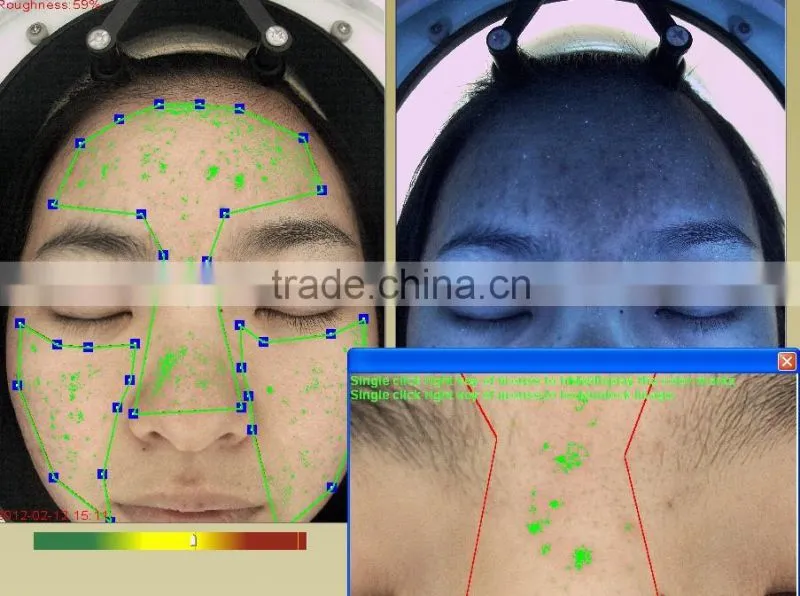 skin analyzer magnifier machine skin analysis system