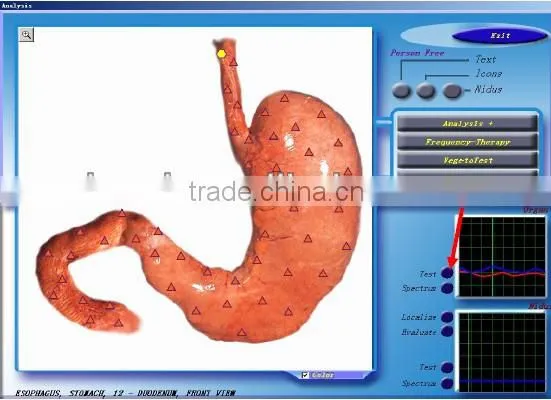 New Arrival 3D NLS Non-liner Analysis System Meridian Health Analyzer