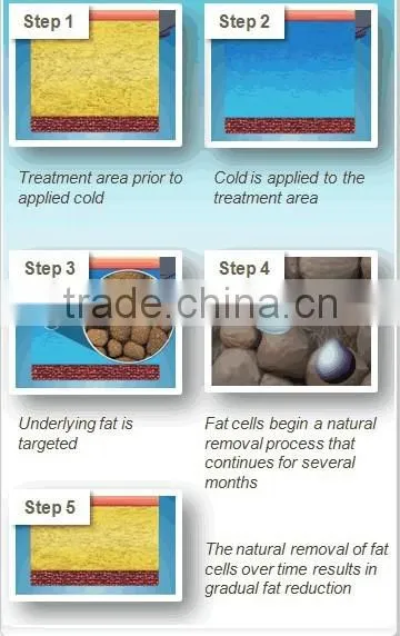 2016 Freezing Fat Cell Slimming Loss Weight Cryolipolysis Machines