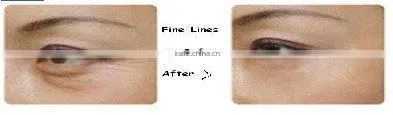 Q10 Anti-Wrinkle Crystal Eye Mask Gold Collagen