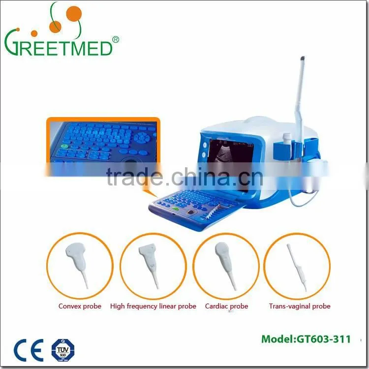 High quality new design cheap ultrasound machine