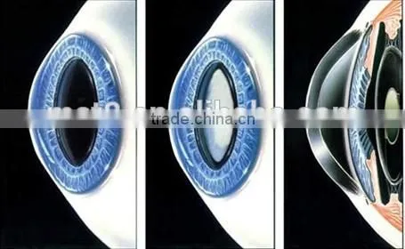 New MCT/RGP Technology contact lenses/ professional online service from China