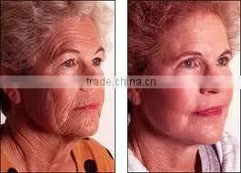 Vacuum cavitation system supersonic multifunctional beauty equipment for body shaping