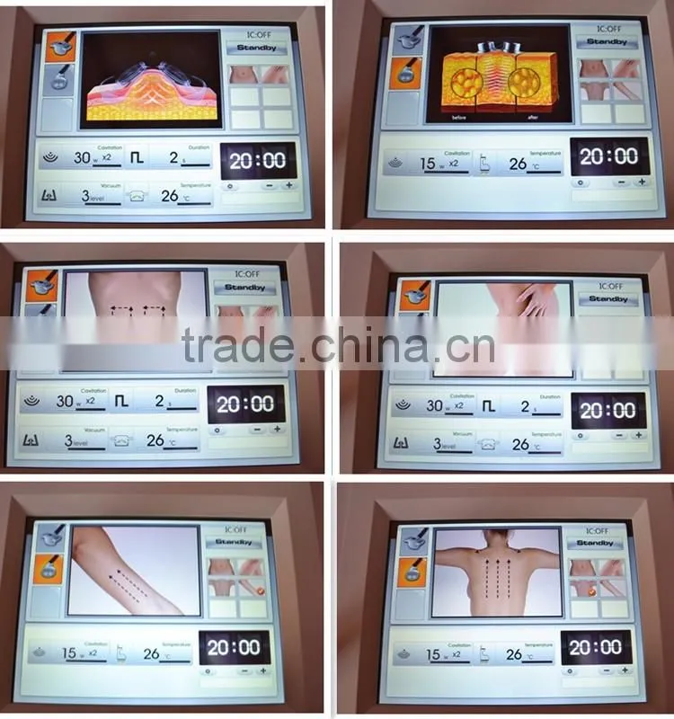 20156 Advanced VACA Shape Ultrasound Machine Cellulite Reduction