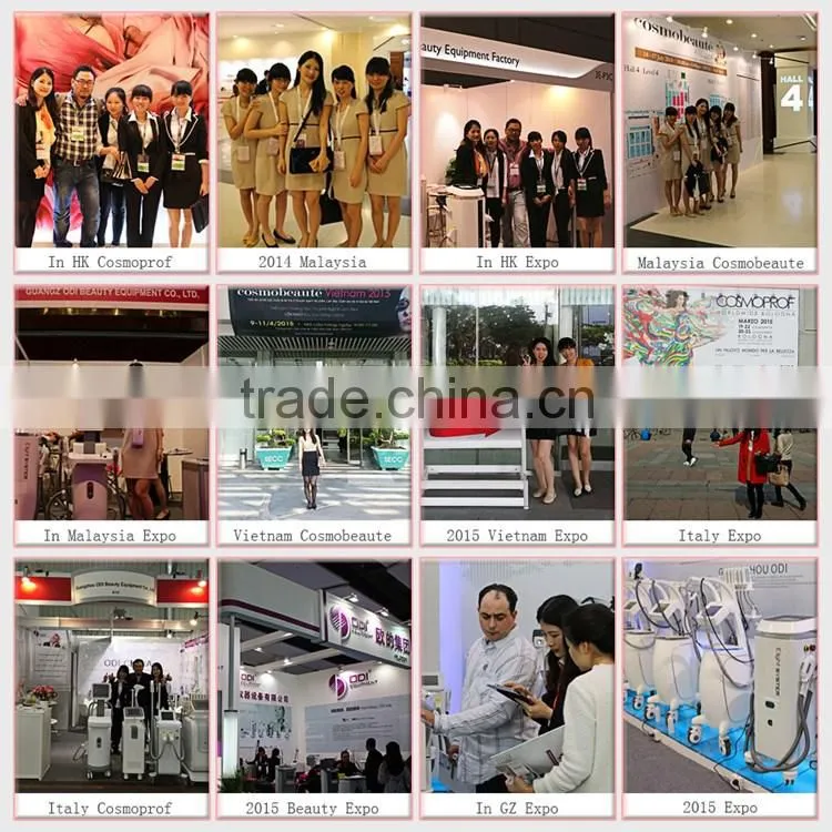 Total counts 20.000.000 shots diode laser 980nm vascular removal machine