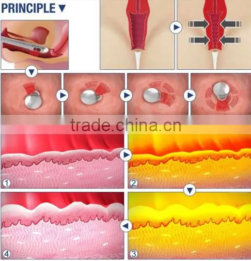 Medical CE RF TUBE Fractional CO2 Laser for acne scars removal and fractional skin resurfacing