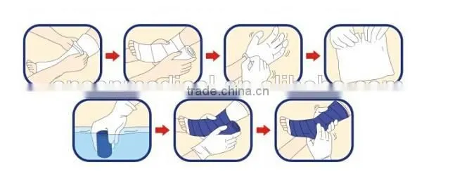 Hot Selling Moisture Resistant Medical Consumbles Orthopedic Fiberglass and Polyester Casting Tape