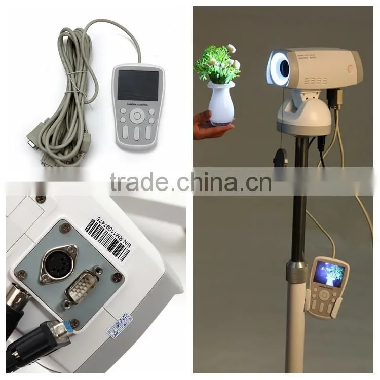 Factory price Medical Gynaecology Device portable Digital Video Colposcope for sale
