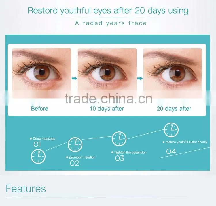 Electric Eye Care Massager for Remove Eye Wrinkle Eye Bag