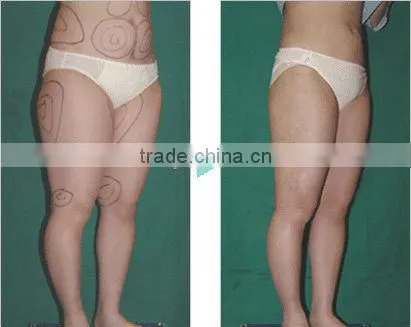 5 Treatment Head Cavitation Tripolar RF Vacuum Body Slimming Machine F019