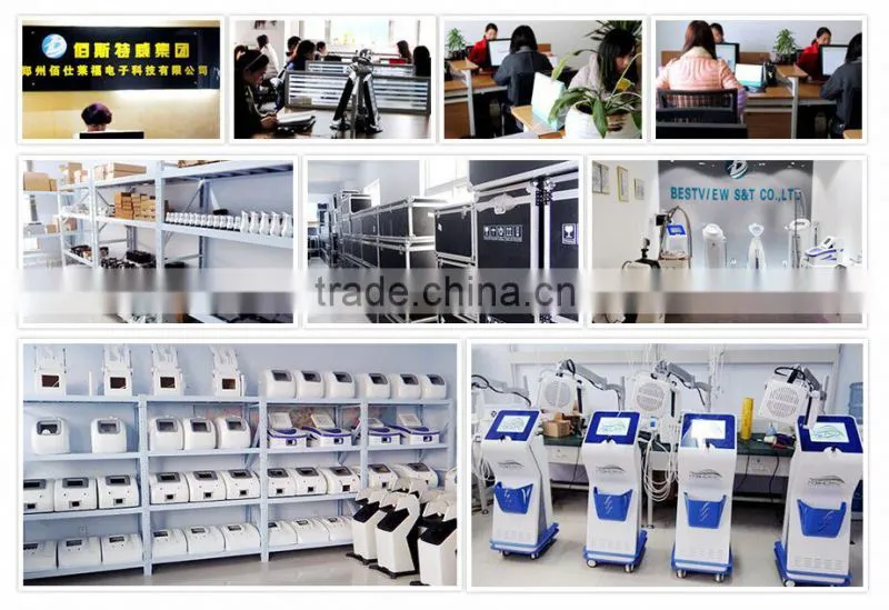 2016 hot sale q switched nd yag laser tattoo removal facial machine korea