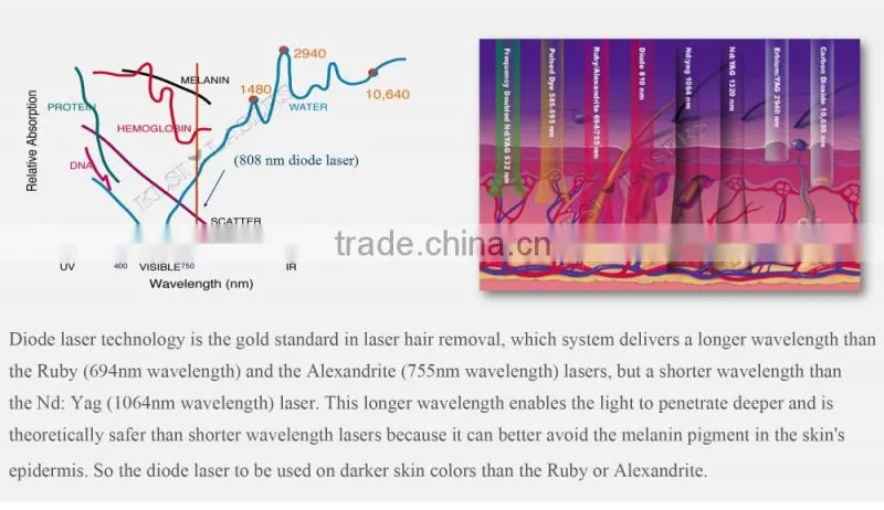 Laser permanent hair epilation equipment 808 diode machine