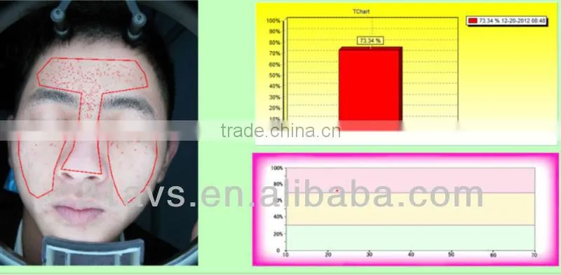 Guangzhou facial skin analysis machine