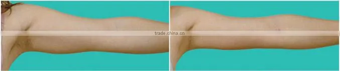 alibaba best selling arm trimming sleeve, new exercise arm slimming belt