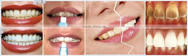 Teeth Whitening Strips Oral Hygiene Dental Care No Peroxide Kits Tooth Whitening Strips