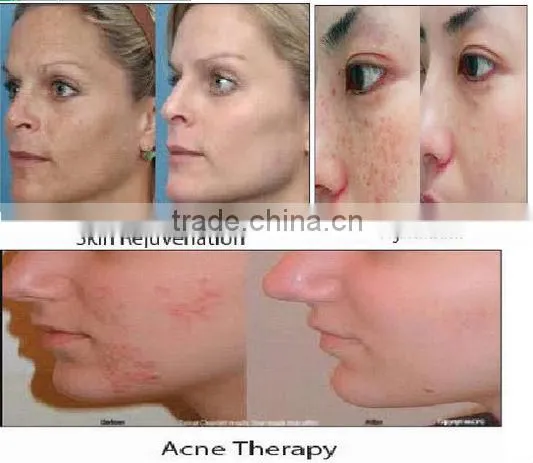 Factory price led light therapy medical device, led photon light therapy device for skin care