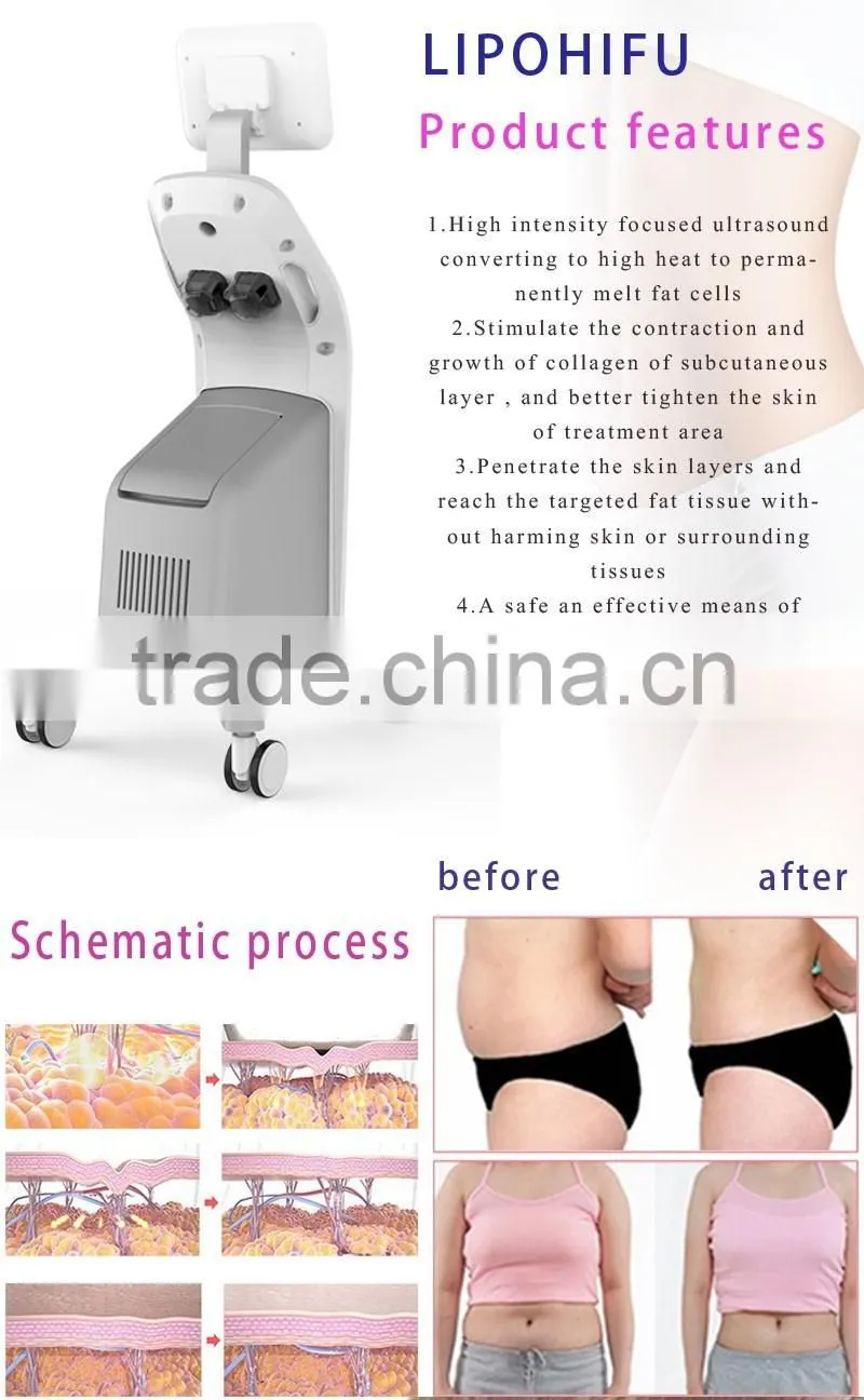 FU13-2S 2016 best selling products non surgical body lift for cellulite reduction popular in USA