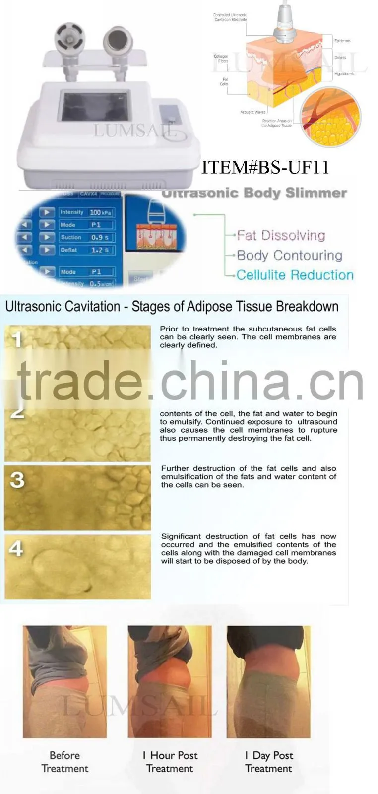 shockwaves machine assisted with Ultrasonic treatments Lipo Cavitation/Fat Cavitation