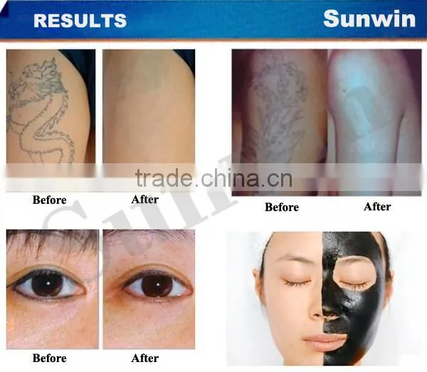Multi Functional 3 in1 E-light Ipl RF hair removal treatment skin care Machine