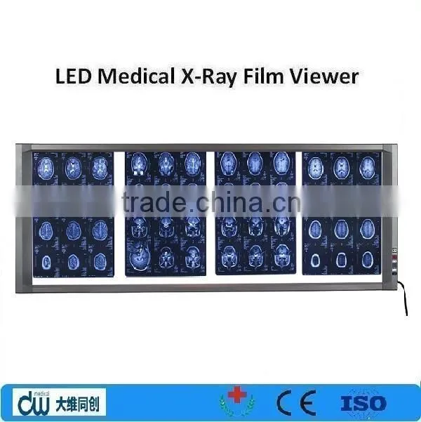 medical LED adjustable film viewer / x ray machine/ negatoscope