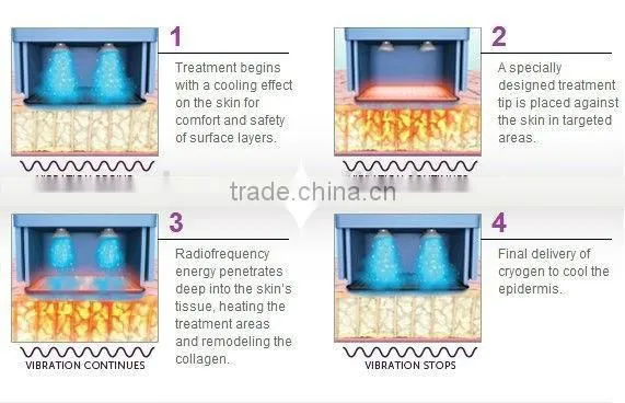 alibaba china rf fractional multipolar rf machine