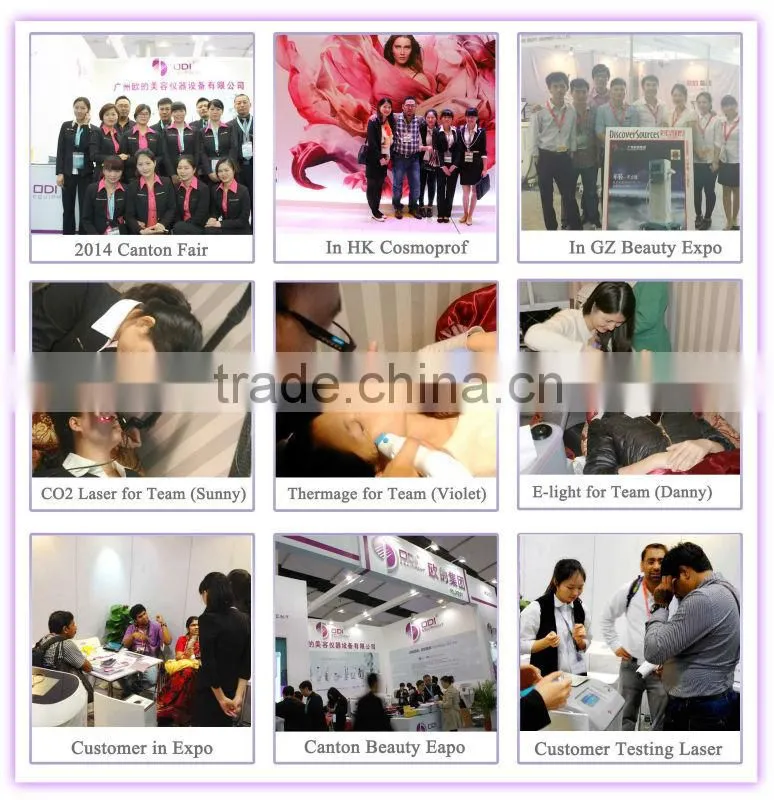 Three cryo treatment handles slim freezer weight loss