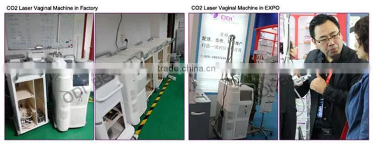 OD-V8 Professional fractional co2 laser treatment with beautiful vaginas