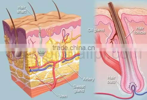 Medical best epilator machine for wholesales