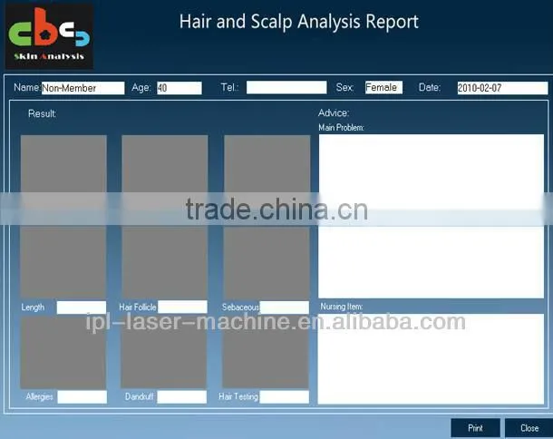 High definition hair analyzer mcahine