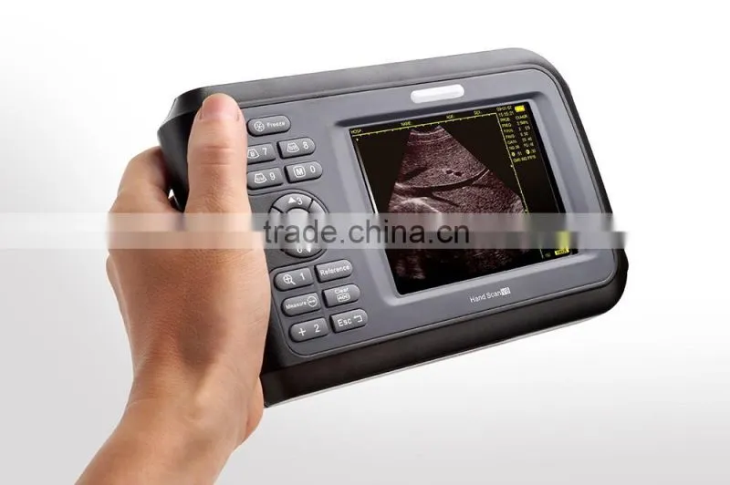V8 Handle type Digital veterinary ultrasound scanner