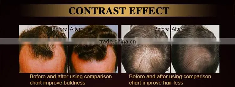 Female massage hair growth machine