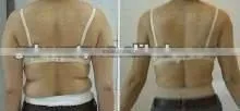 WS-30B Cool tech fat freezing machine
