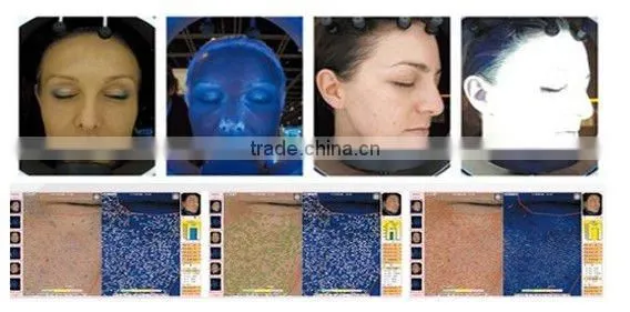 magic mirror skin analyzer