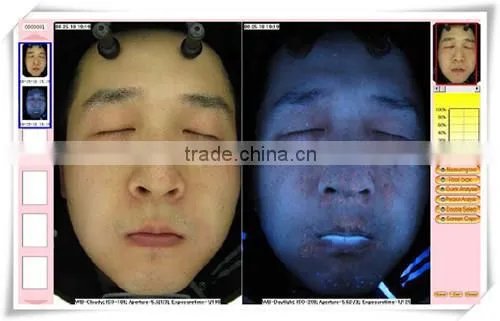 CE approved boxy skin & hair analyser