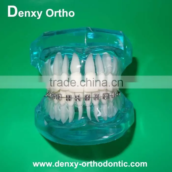 differnt types OEM dental orthodontic study model