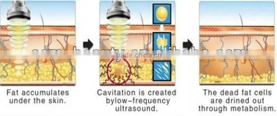ABS material multi-functional ultrasound liposuction/weight loss machine