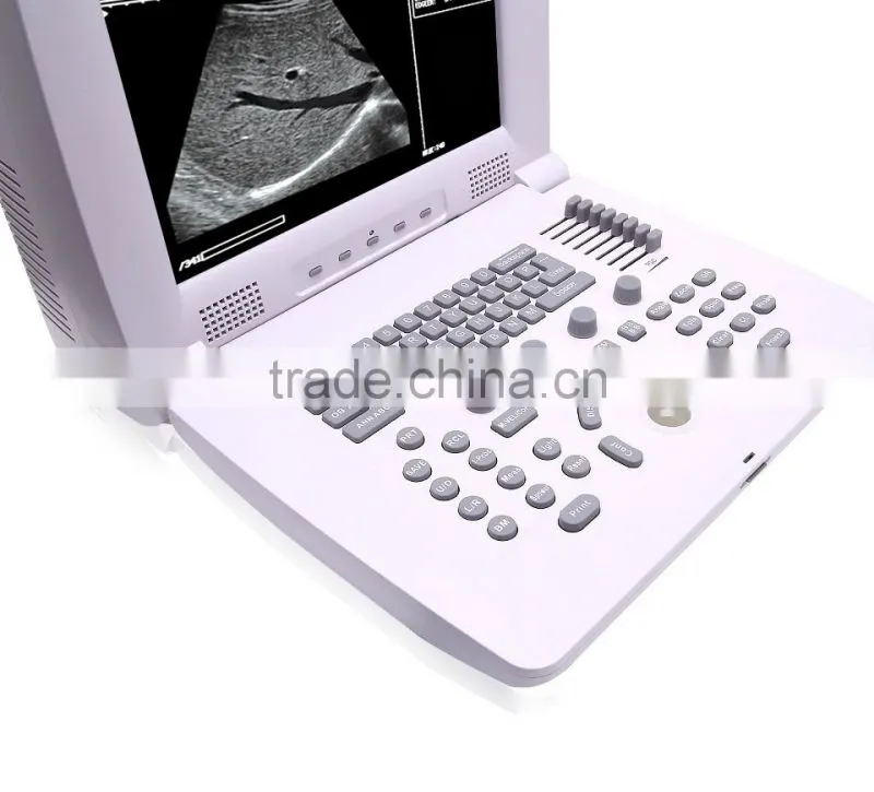 OB/GYN CE FDA Compact Multi-purpose Portable Doppler Ultrasound Scan