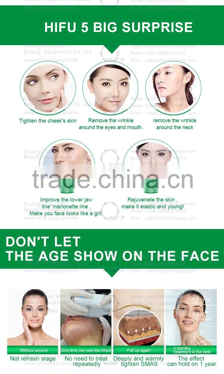 2016 new technology medical hifu machine for face lift and wrinkle removal