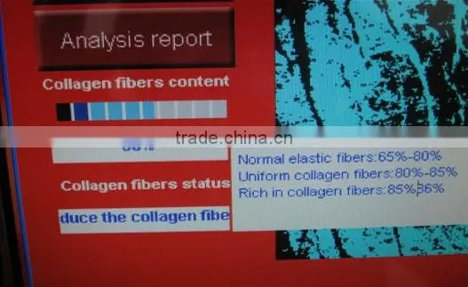 Intelligent top cbs CE FCC approved vertical skin analyzer