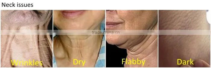 Ms.W High Quality Vibrating Perfect Health Neck Massager Neck Skin Care Tools