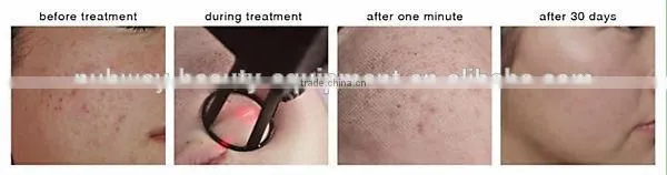 High quality competitive price co2 laser tube 400w