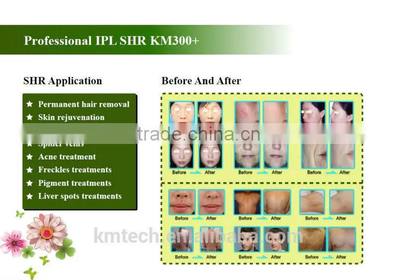 2014 portable In motion ipl laser facial rejuvenation machine