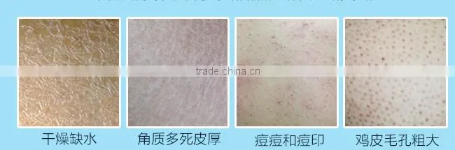 Nature extract jasmine/starwberry/lemon/blueberry/rose /pinch/aloe /vanilla Skin Whitening Shower Gel