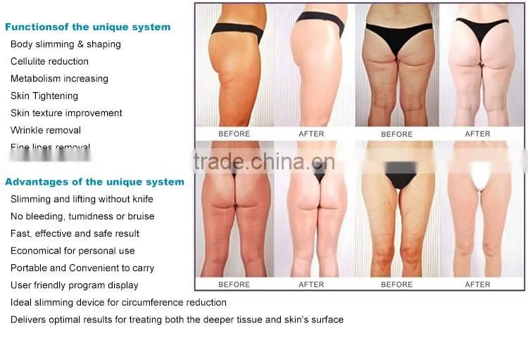 Portable Ultrasound Rf Slimming Machine face lifting and body slimming