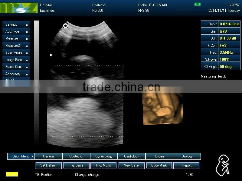 ultrasound machine ,ultrasound machine price,ultrasound scanner
