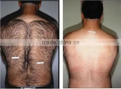 Home use ipl skin whitening hair removal beauty machine with ipl handpiece AP-TK AP-TK