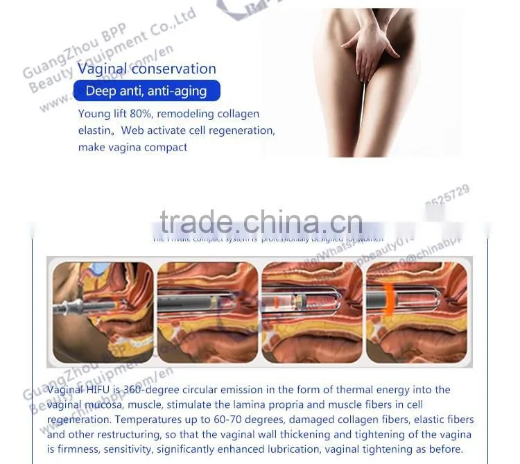 BPP wholesale hifu vaginal tightening machine
